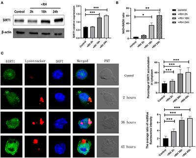 The role of SIRT1 in the process of Toxoplasma gondii infection of RAW 264.7 macrophages